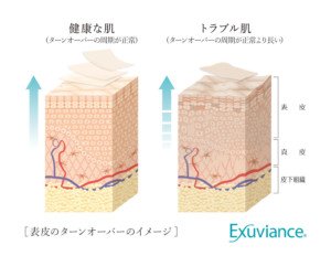 04-skin_image-300x232